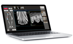 EzRay Air Vet X Ray (hand held) with Sensor & Laptop